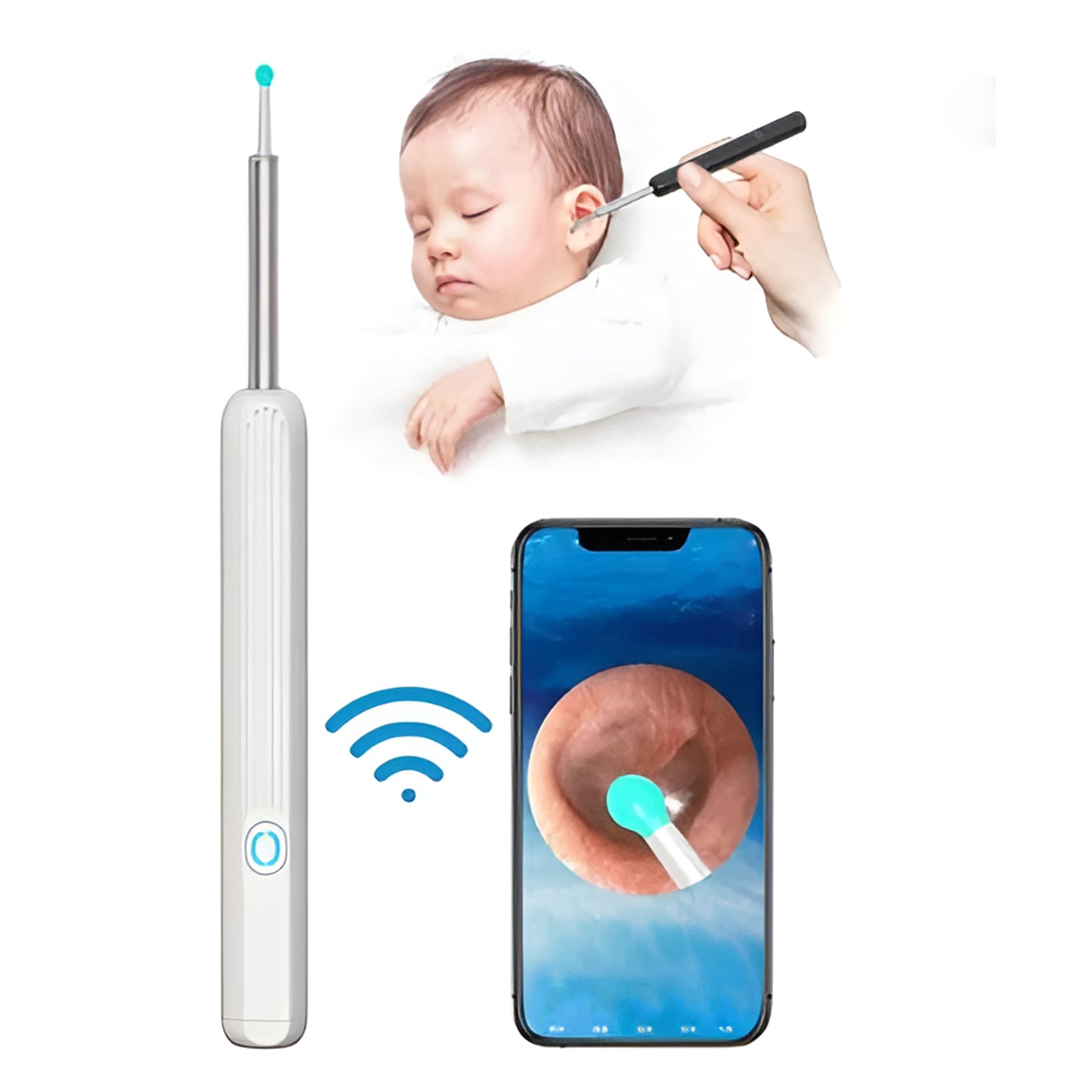 Earwax Removal Kit – Smart Visual Earwax Removal Tool