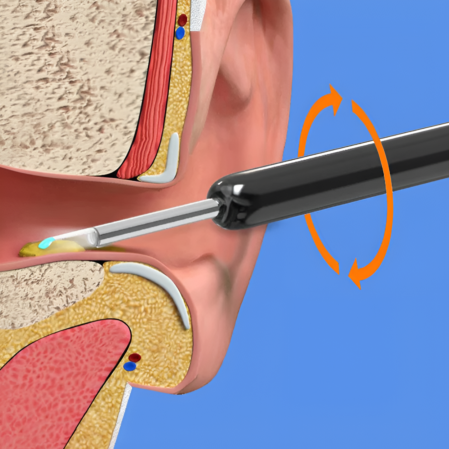 Earwax Removal Kit – Smart Visual Earwax Removal Tool